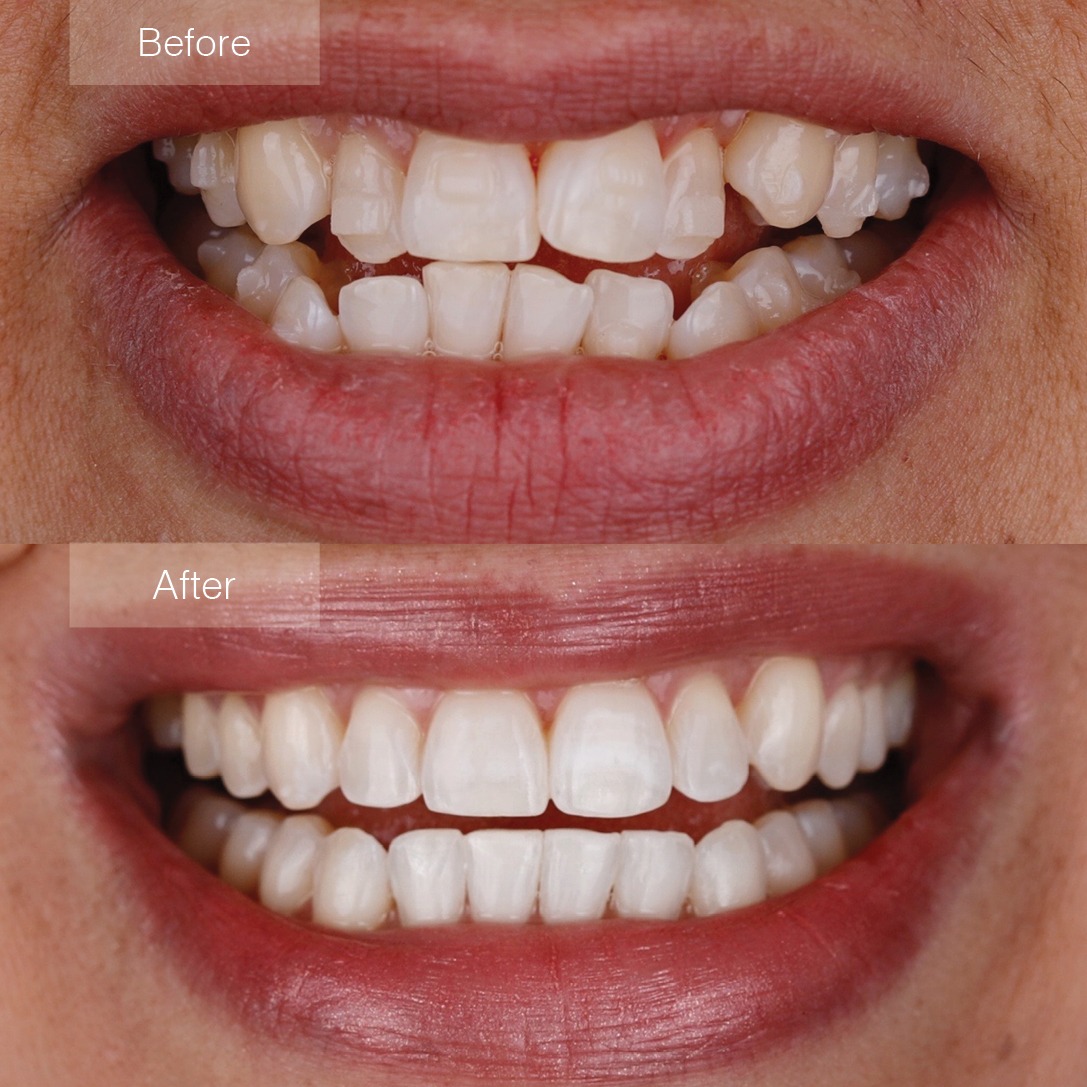 Orthodontic Transformation